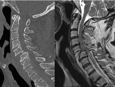 脊椎脊髄外科 | 関西医科大学整形外科学講座