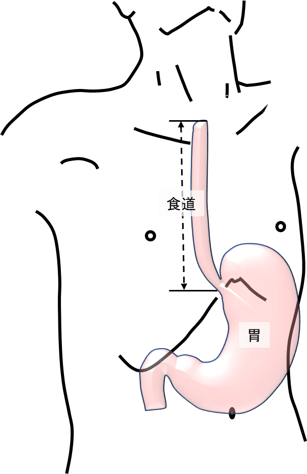 食道 | 関西医科大学上部消化管外科学講座
