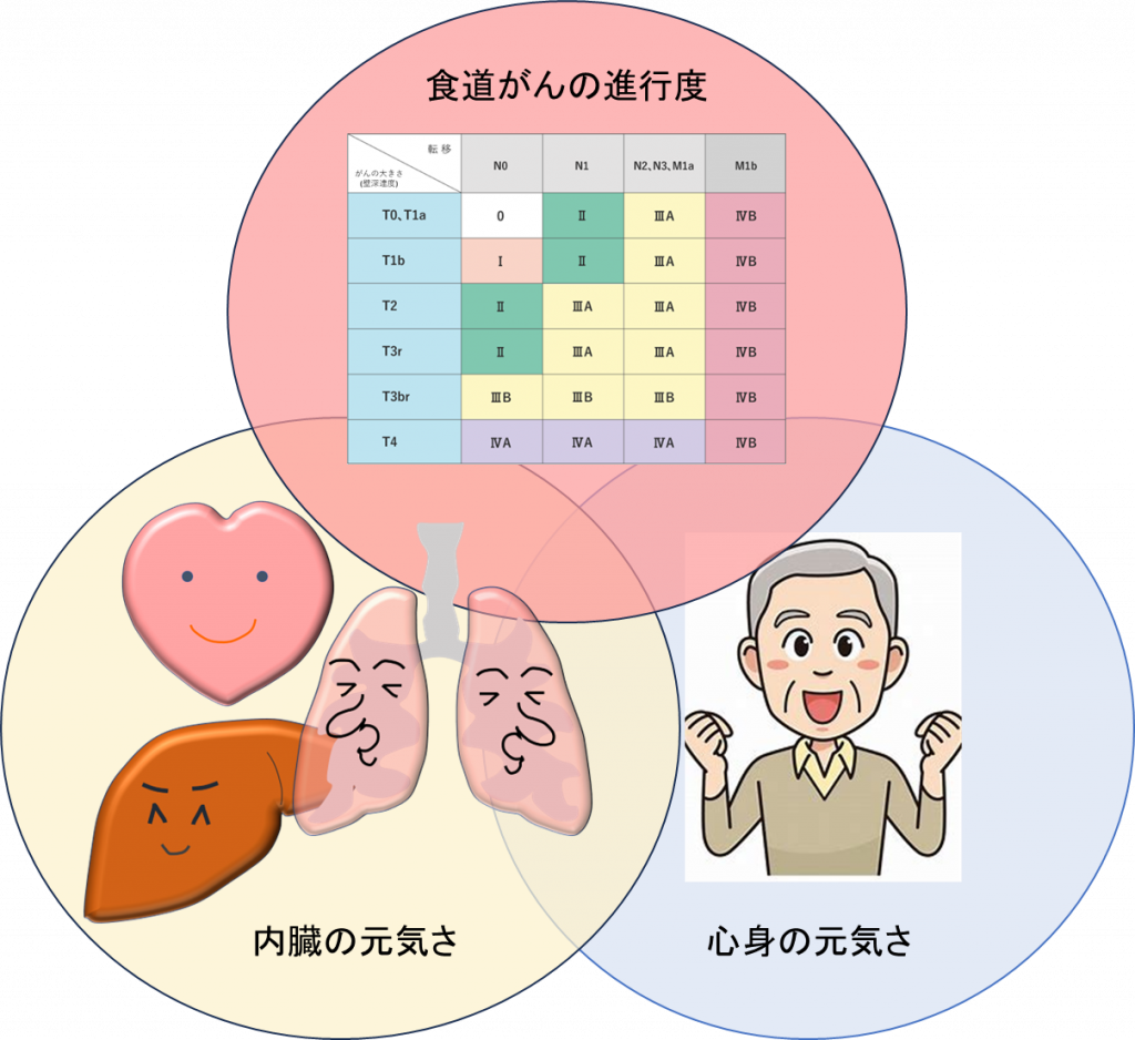 食道 が ん 進行 速度